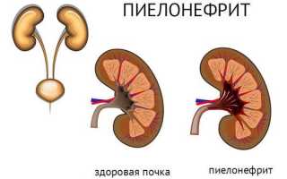 Моча розового цвета у мужчин
