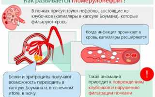Острый гломерулонефрит классификация