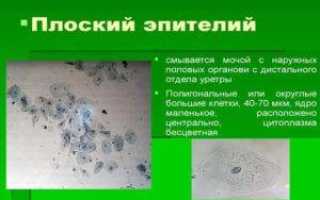 Что означает эпителий плоский в анализе мочи