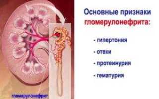 Признаки заболевания почек у мужчин