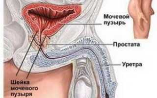 Сгустки крови в моче